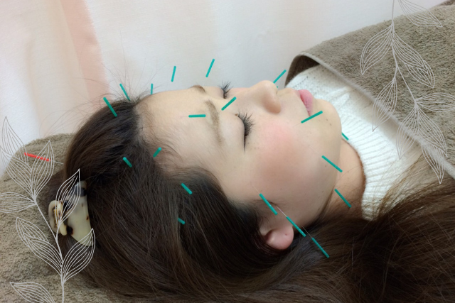 極細の鍼を使用しお肌の奥の細胞を活性化し、ターンオーバーを促進しお肌のはりやシワを薄くするなどんの美容効果が期待できます。